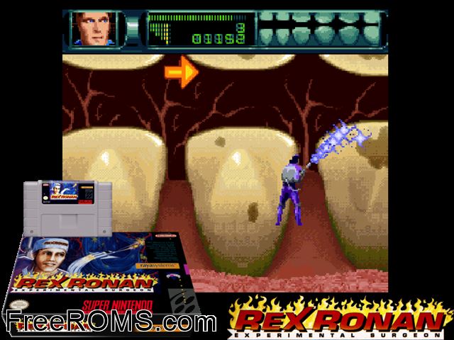 Rex Ronan - Experimental Surgeon SNES game showing 3D box cover and gameplay screenshot